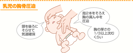 乳児の胸骨圧迫